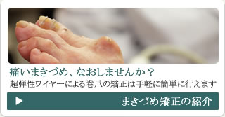 まきづめの矯正の紹介
