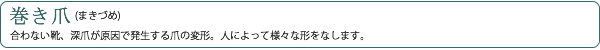 巻き爪