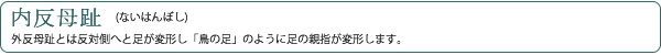 内反母趾