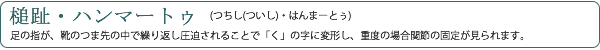 槌趾・ハンマートゥ