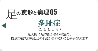 多趾症
