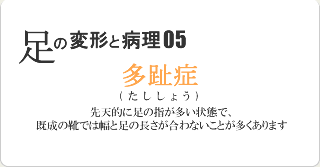 多趾症