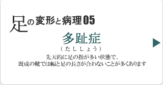 多趾症
