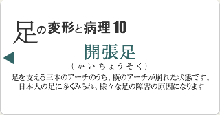 開張足