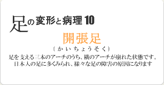 開張足