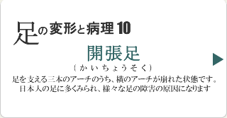 開張足