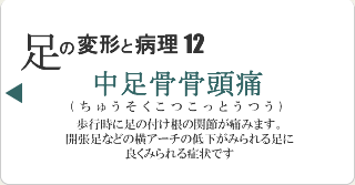 中足骨骨頭痛