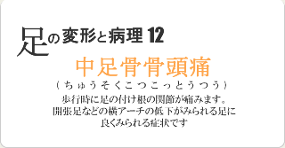 中足骨骨頭痛