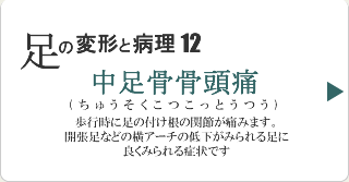 中足骨骨頭痛