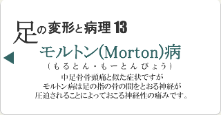 モルトン病