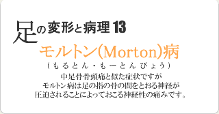 モルトン病