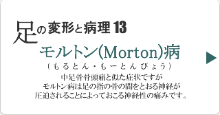 モルトン病