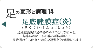 足底腱膜症