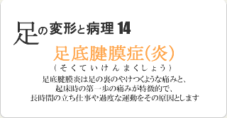 足底腱膜症