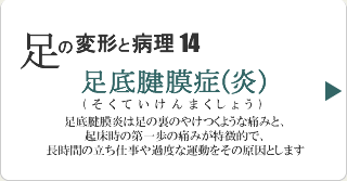 足底腱膜症