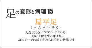 扁平足