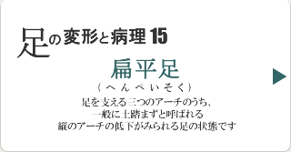扁平足