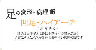 凹足・ハイアーチ