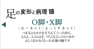 O脚・X脚