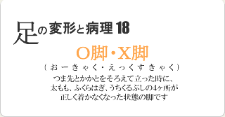 O脚・X脚