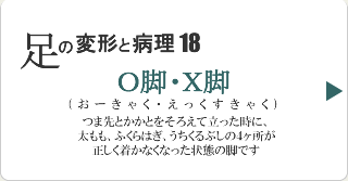O脚・X脚