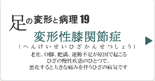 変形性膝関節症