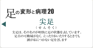 尖足
