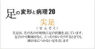 尖足