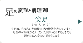 尖足