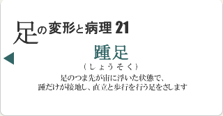 踵足