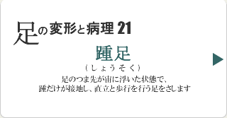 踵足