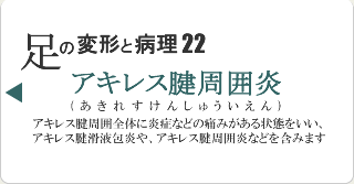 アキレス腱周囲炎