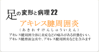 アキレス腱周囲炎
