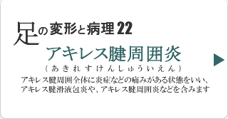 アキレス腱周囲炎