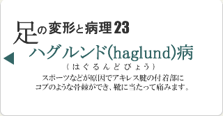 ハグルンド病