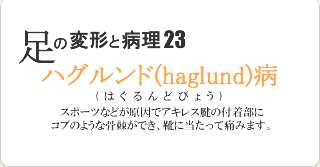 ハグルンド病