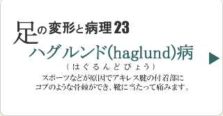 ハグルンド病