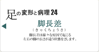 脚長差