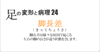 脚長差