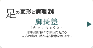 脚長差