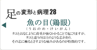 魚の目(鶏眼)