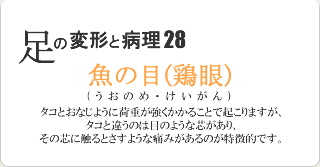 魚の目(鶏眼)