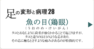 魚の目(鶏眼)