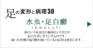 水虫(足白癬)